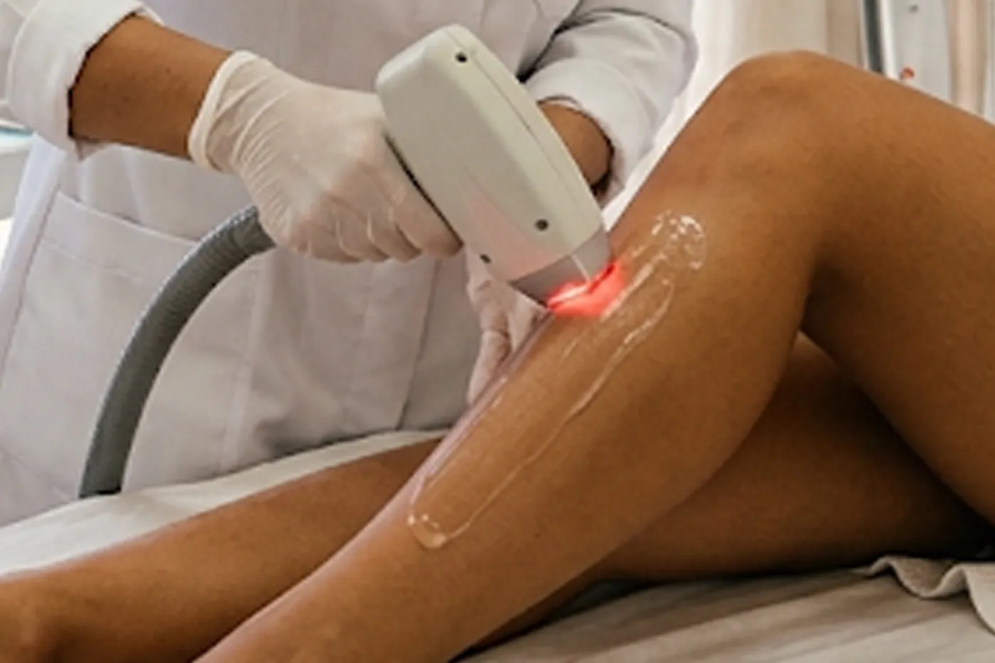 Aplicador de laser sobre a pele, com óculos de proteção